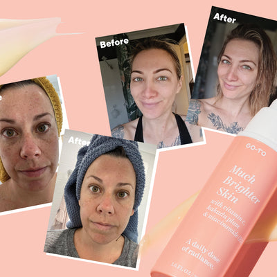 Two Ways That Vitamin C Can Help With Your Skin Goals