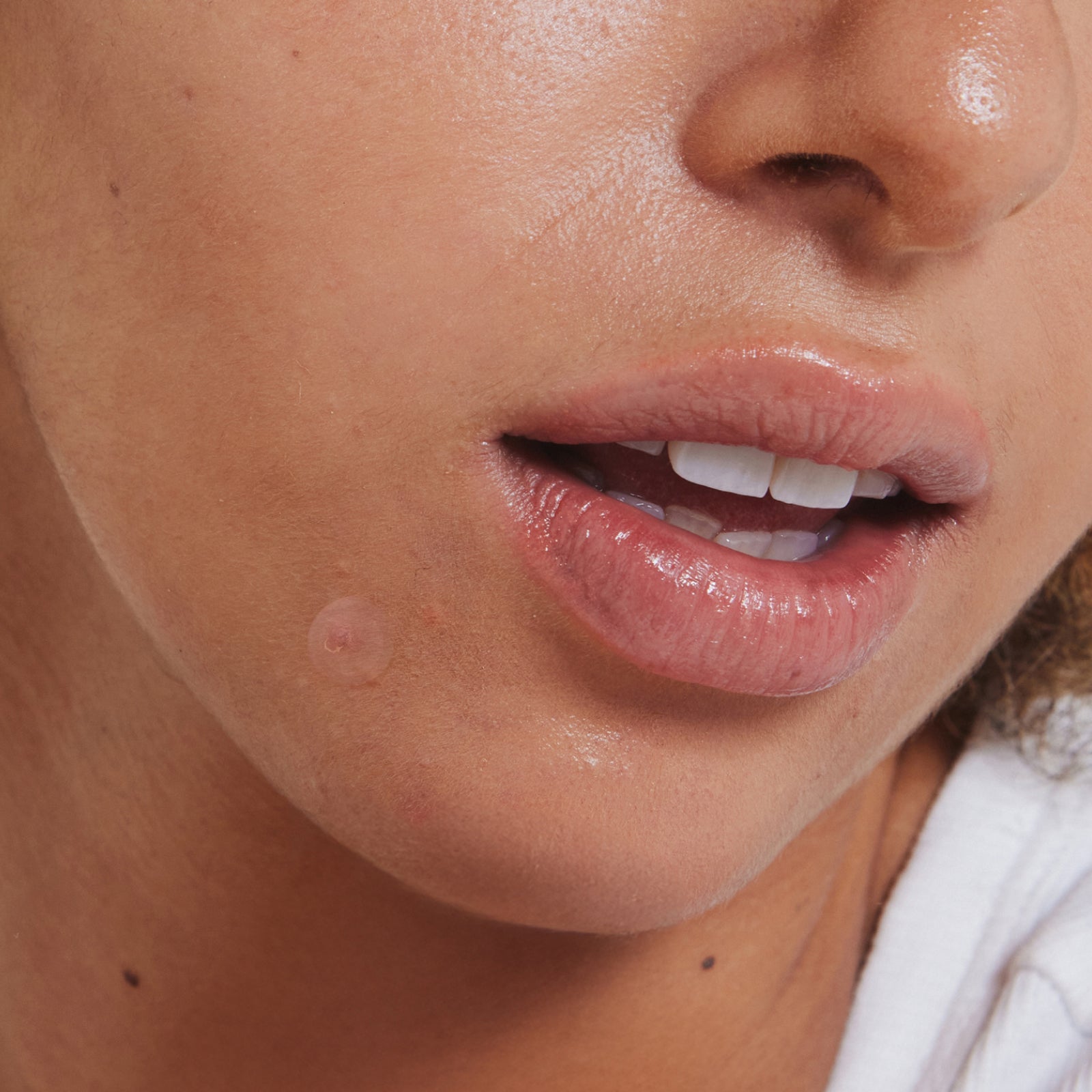 Beat The Breakouts Gifts & Sets Go-To Skincare
