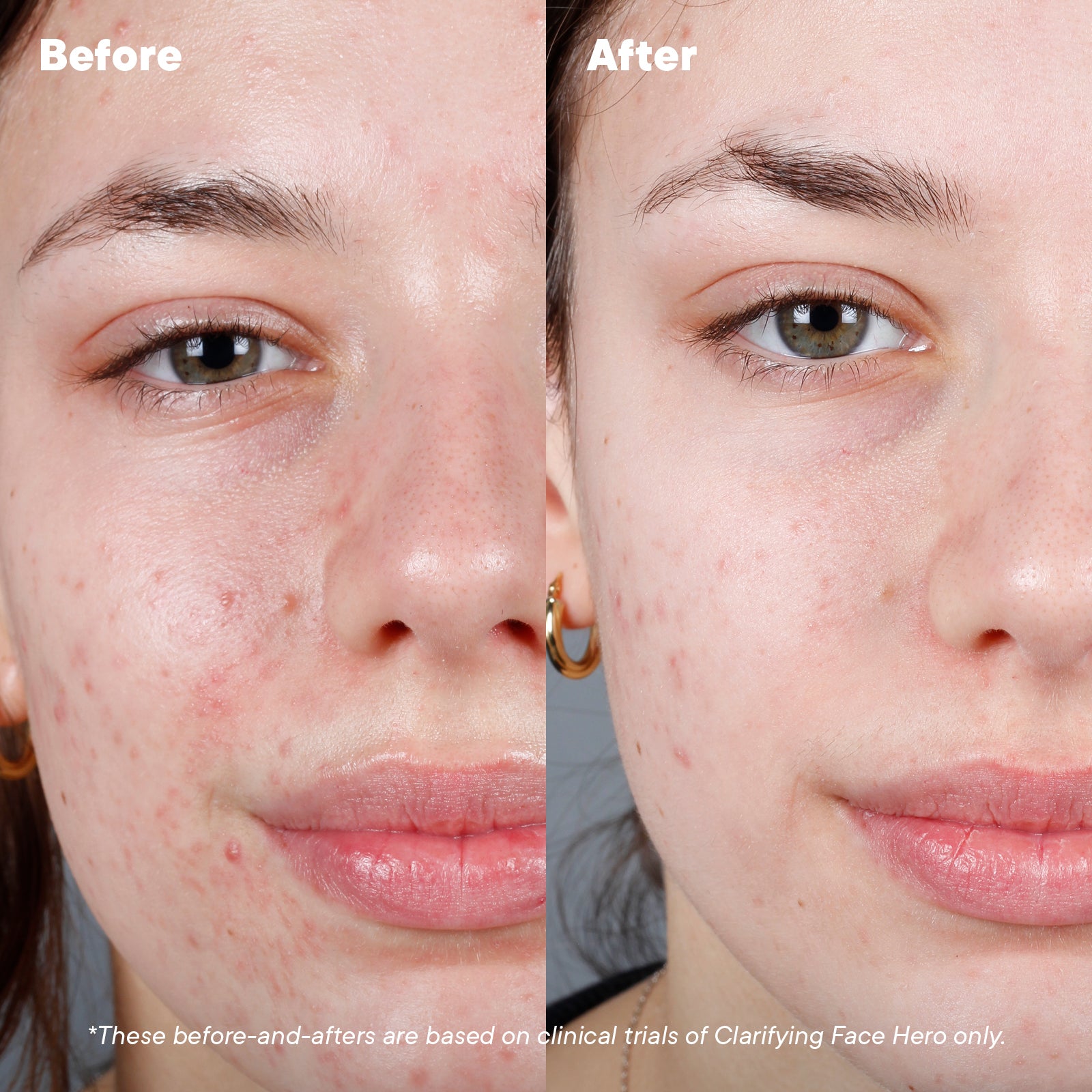 The Clarifying Effect Gifts & Sets Go-To Skincare