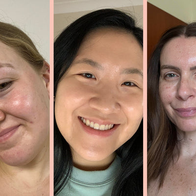 How Much Plumper Skin Works For Different Skin Types