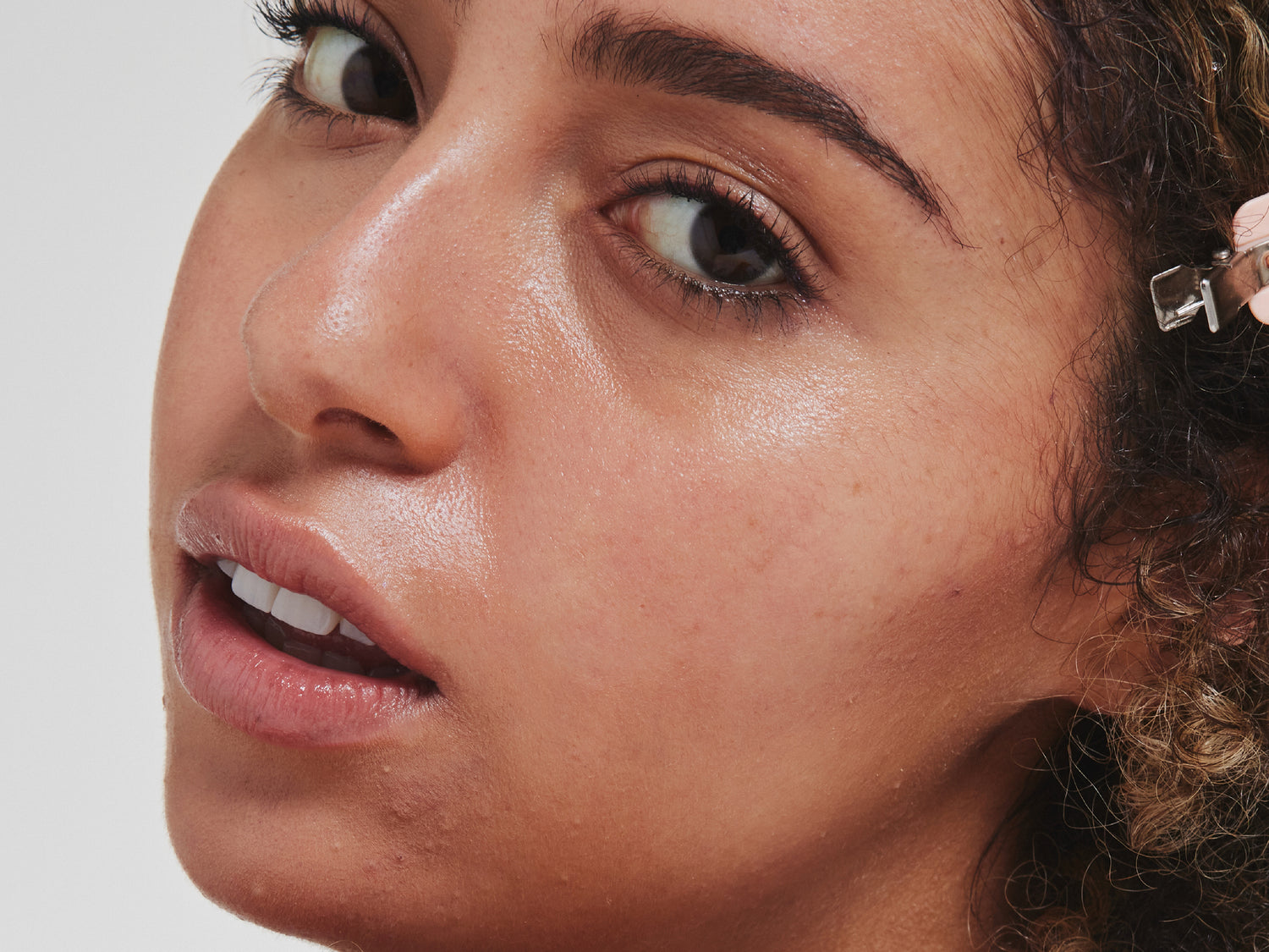 Everything You Need To Know About Using Retinal To Manage Acne