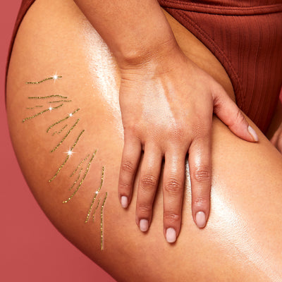 Everything You Need To Know About Stretch Marks